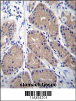 CA1 Antibody (N-term)