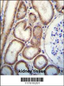 CLEC3B Antibody (Center)