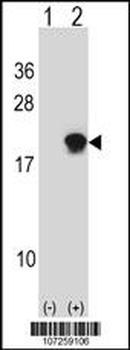 SUMO4 Antibody (Center)