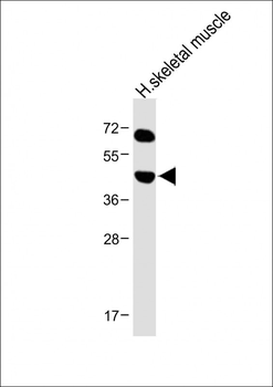 KERA Antibody (C-term)