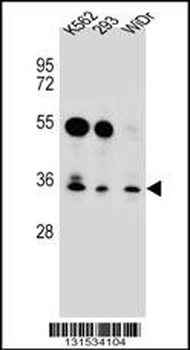 GLIPR1L2 Antibody (N-term)