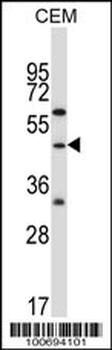 CBLC Antibody (N-term)