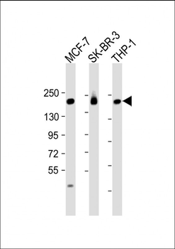 PREX1 Antibody (C-term)
