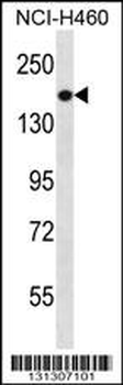 PREX1 Antibody (C-term)