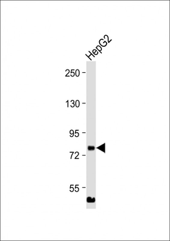 MLXIPL Antibody (C-term)