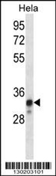 NDUFS8 Antibody (Center)