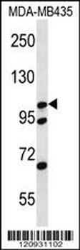 CTNND2 Antibody (C-term)