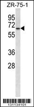 GPD2 Antibody (C-term)