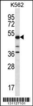 PSTPIP1 Antibody (N-term)