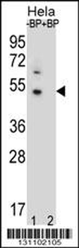 DNAJB6 Antibody (Center)