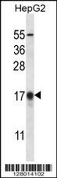 APG8b(MAP1LC3B) Antibody (N-term T29)