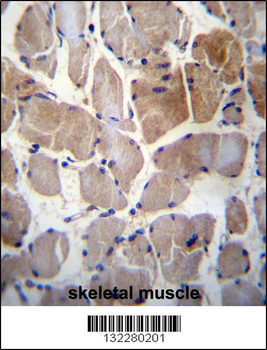 RPS6KC1 Antibody (N-term)