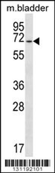EYA1 Antibody (N-term)