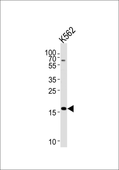 RNF5 Antibody (Center)