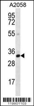 CNN2 Antibody (N-term)