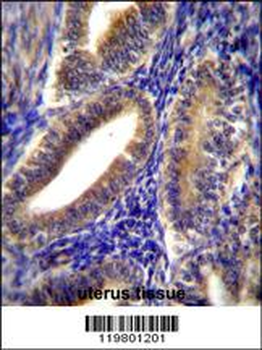 CNN2 Antibody (N-term)