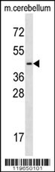 TCF7L2 Antibody (N-term)