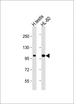 SENP6 Antibody (C-term)