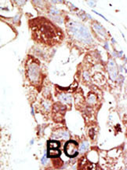 SENP6 Antibody (C-term)