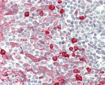 SENP6 Antibody (C-term)