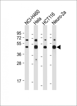 SLC16A3 Antibody (C-term)