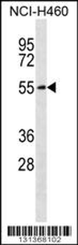 SLC16A3 Antibody (C-term)