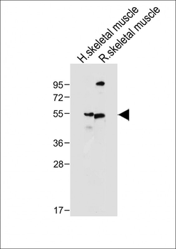 SLC16A3 Antibody (C-term)