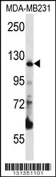 PITRM1 Antibody (Center)
