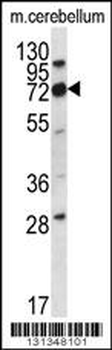 IGSF8 Antibody (Center)