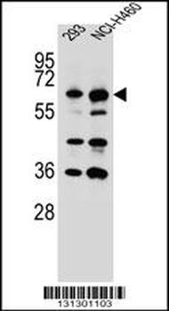CKAP4 Antibody (C-term)
