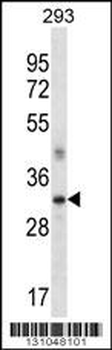 SFRP2 Antibody (C-term)
