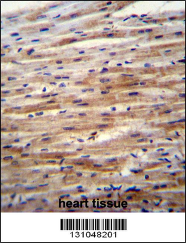SFRP2 Antibody (C-term)