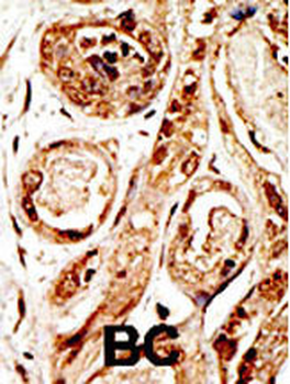 SENP3 Antibody (N-term)