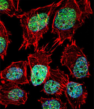 FOXO6 Antibody (Center)