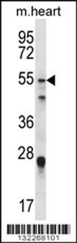 FOXO6 Antibody (Center)