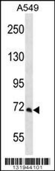 PCCA Antibody (Center)
