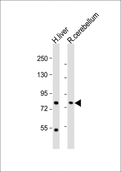 PCCA Antibody (Center)