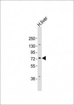 PCCA Antibody (Center)