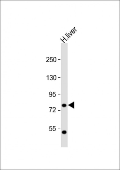 PCCA Antibody (Center)
