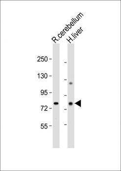 PCCA Antibody (Center)