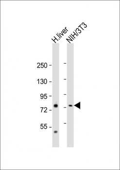 PCCA Antibody (Center)