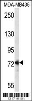 DVL1 Antibody (Center)