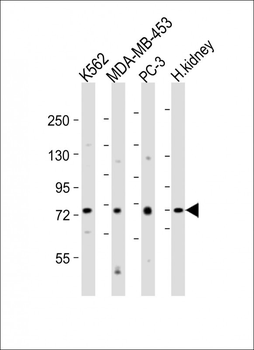 DVL1 Antibody (Center)