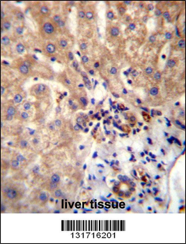 DVL1 Antibody (Center)