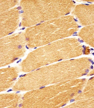 DVL1 Antibody (Center)