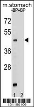 MBOAT4 Antibody (Center)