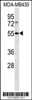 LILRB4 Antibody (N-term)