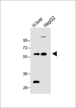FADS2 Antibody (N-term)