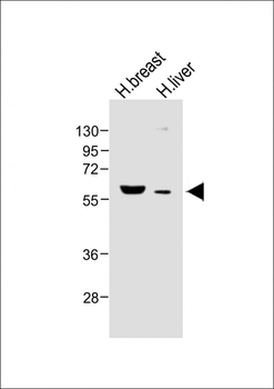 FADS2 Antibody (N-term)