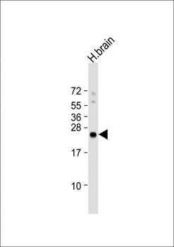 ARHB Antibody (Center)